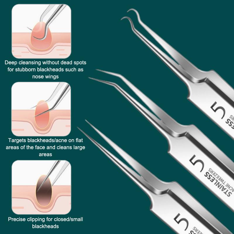 7/8Pcs Blackhead Remover Kit P - đánh giá và giá Skincare