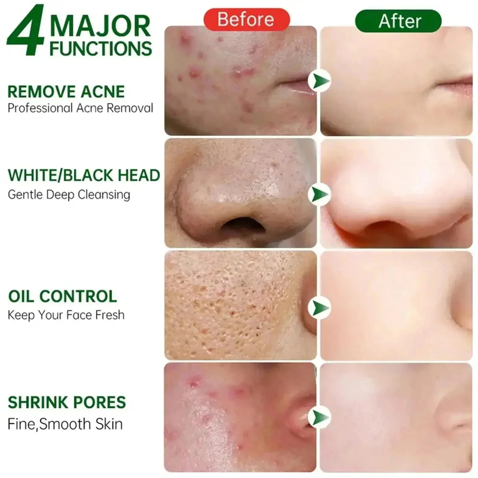 Salicylic Acid Pore Clearing C - đánh giá và giá Salicylic Acid Blackhead Remover