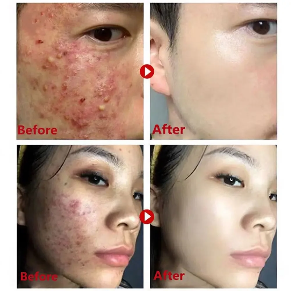 Green Tea Mask Stick Remove Bl - đánh giá và giá Green Tea Cleansing Clay Mask