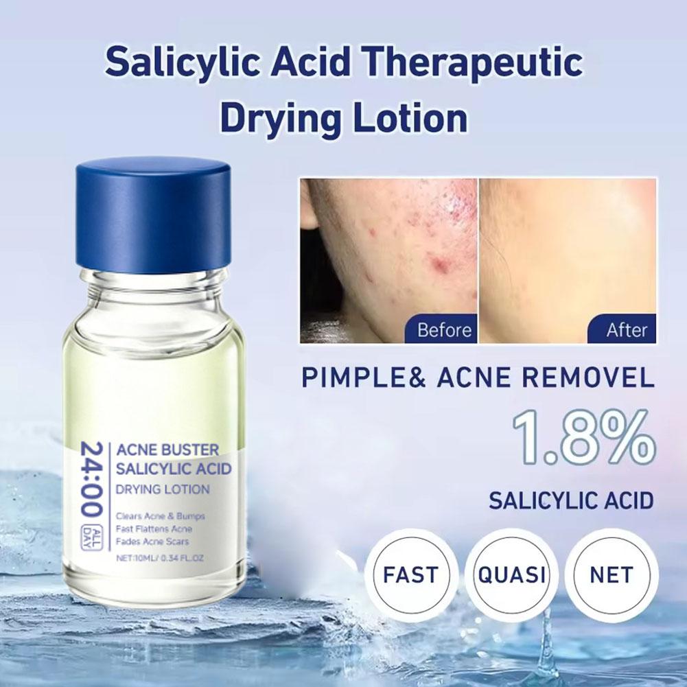 Salicylic Acid Acne Buster Rem - đánh giá và giá Salicylic Acid Blackhead Remover